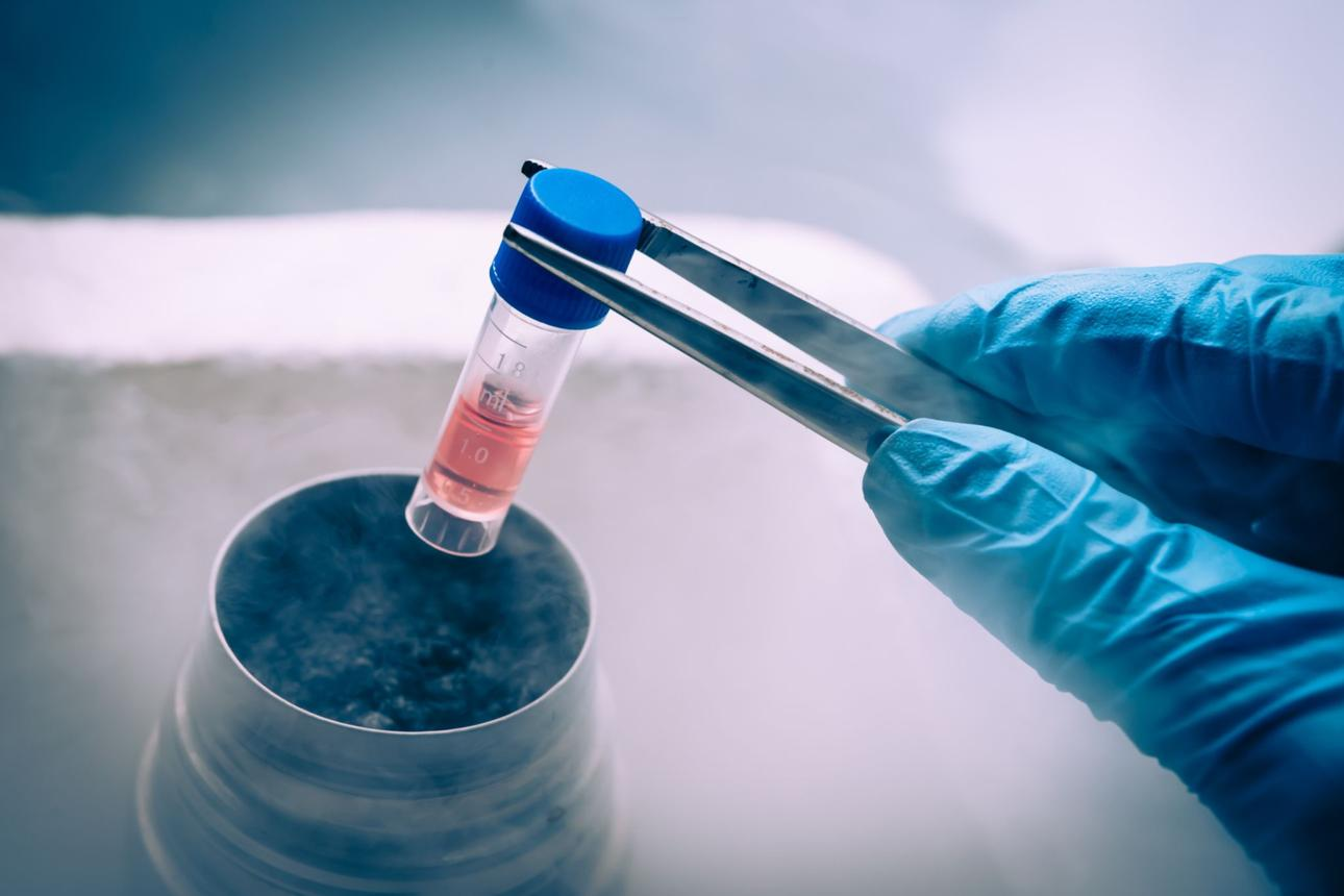Universal Cell Freezing Kit Supplier | High Viability Cryopreservation Solution for Research & Purchase
