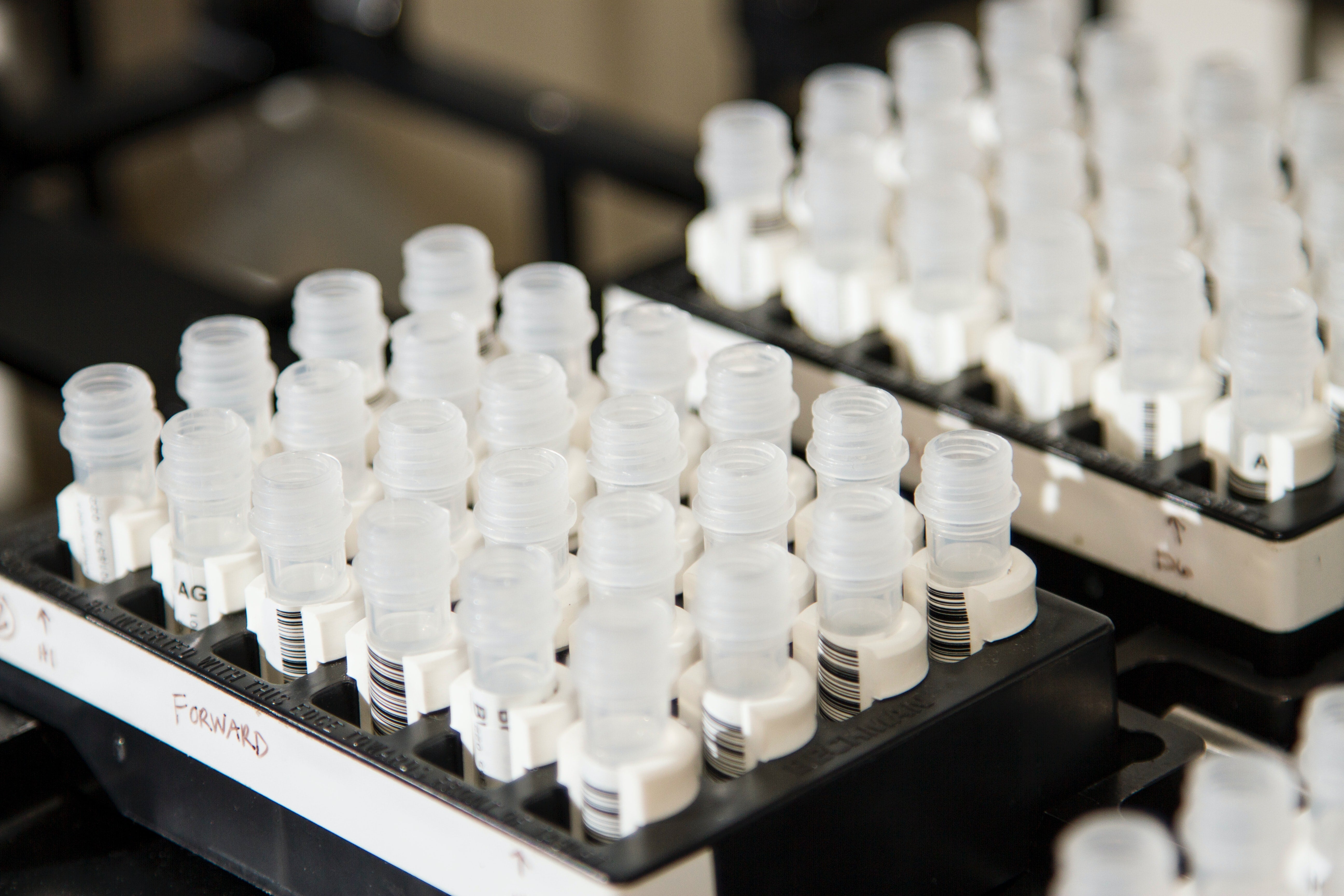 The Benefits of Lyophilized Reagents and Assay Kits