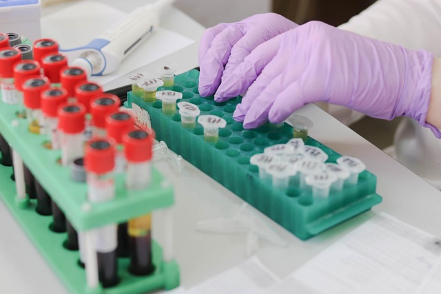 Comparative Analysis of Bacterial Endotoxin Testing Methods: Gel-Clot Assay vs. Kinetic Chromogenic Assay
