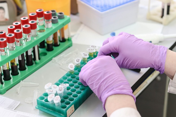 Tachypleus Amebocyte Lysate (TAL) Reagent Sensitivity Verification (λ Confirmation): Ensuring Precision in Endotoxin Detection