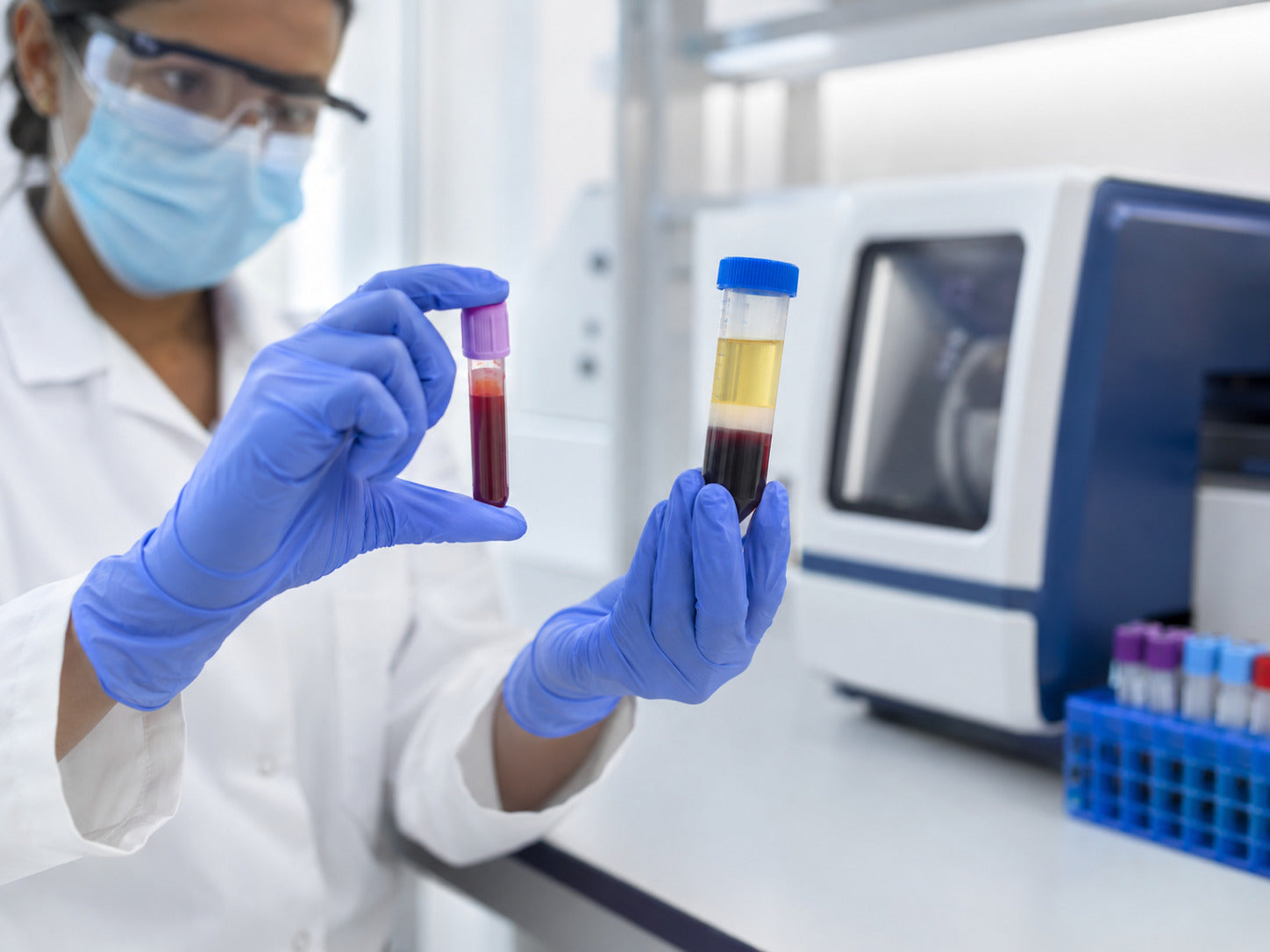 Human PBMC Isolation Solution