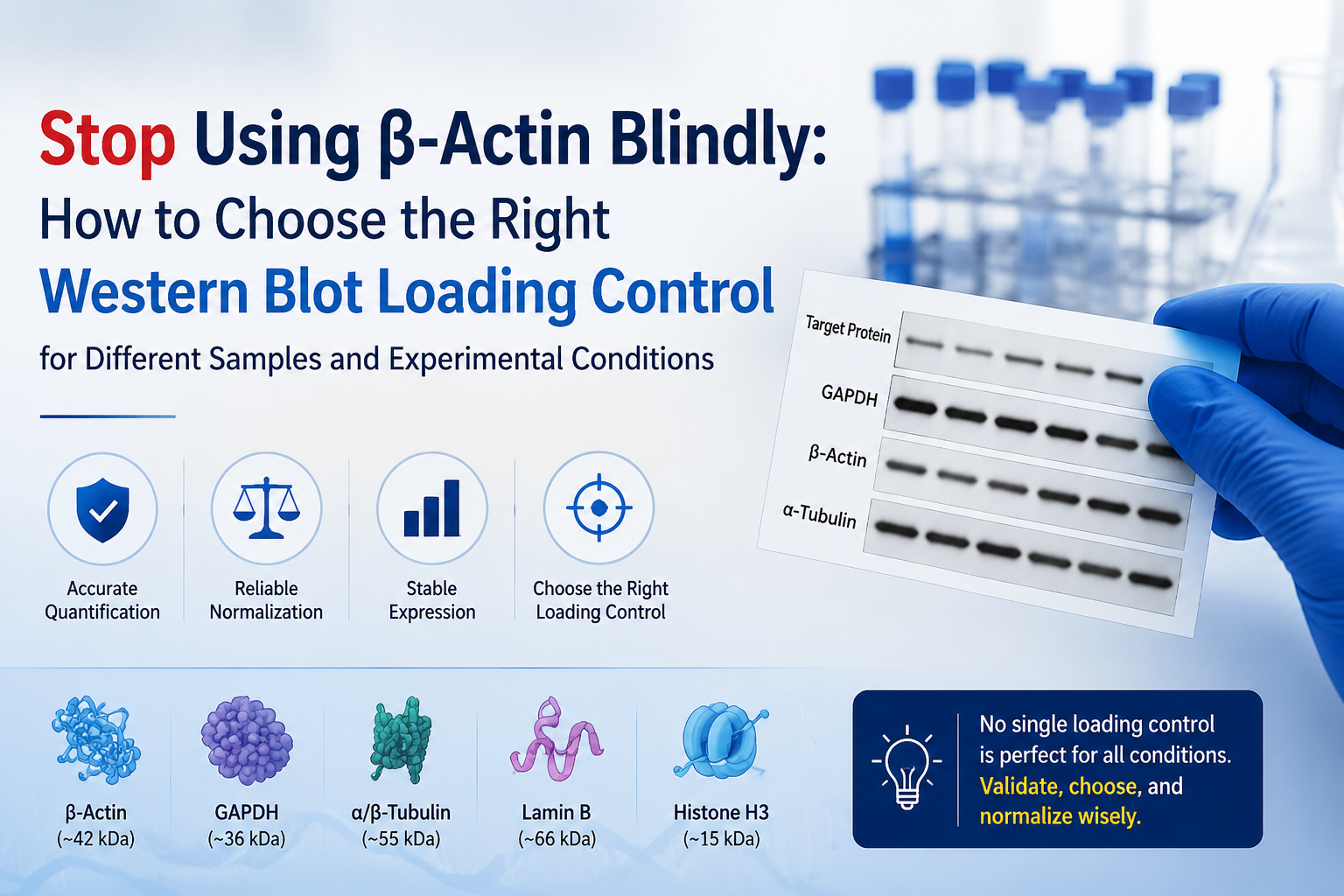 Stop Using β-Actin Blindly: How to Choose the Right Western Blot Loading Control for Different Samples and Experimental Conditions